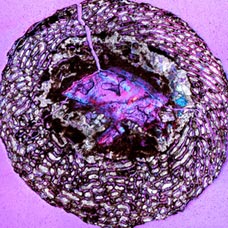 This stained sample of a thin cross section of femur suggests rapid growth.