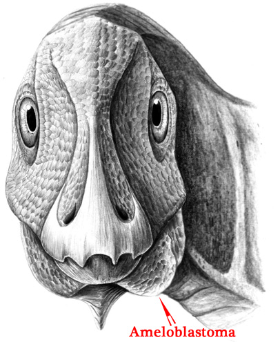 Dinosaur with a facial tumour (Telmatosaurus).