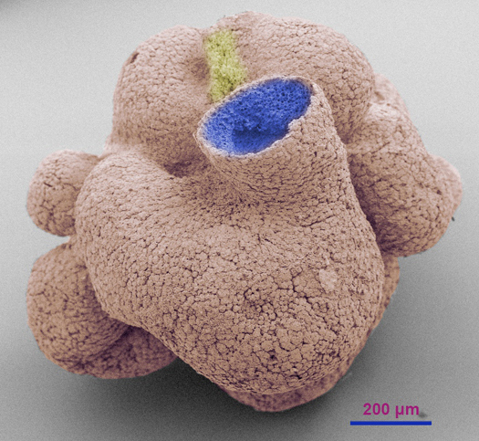 Sponge-like Ediacaran micro-fossil.