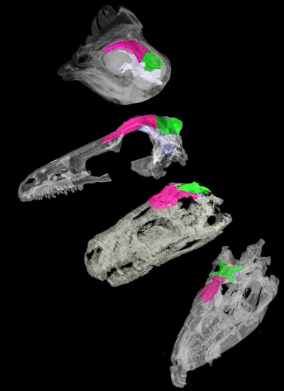 The link between skull development and brain size.