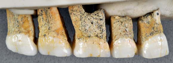 Homo luzonensis teeth.