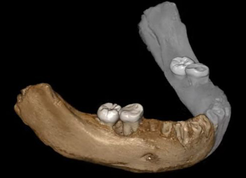 A digital reconstruction of the Xiahe mandible identified as Denisovan.