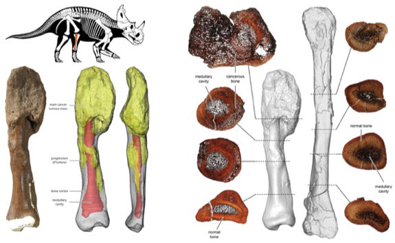 Malignant cancer identified in Centrosaurus fossil bone.